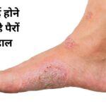 डायबिटीज